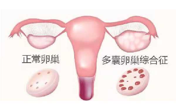 福建代孕供卵流程-六院供卵试管婴儿